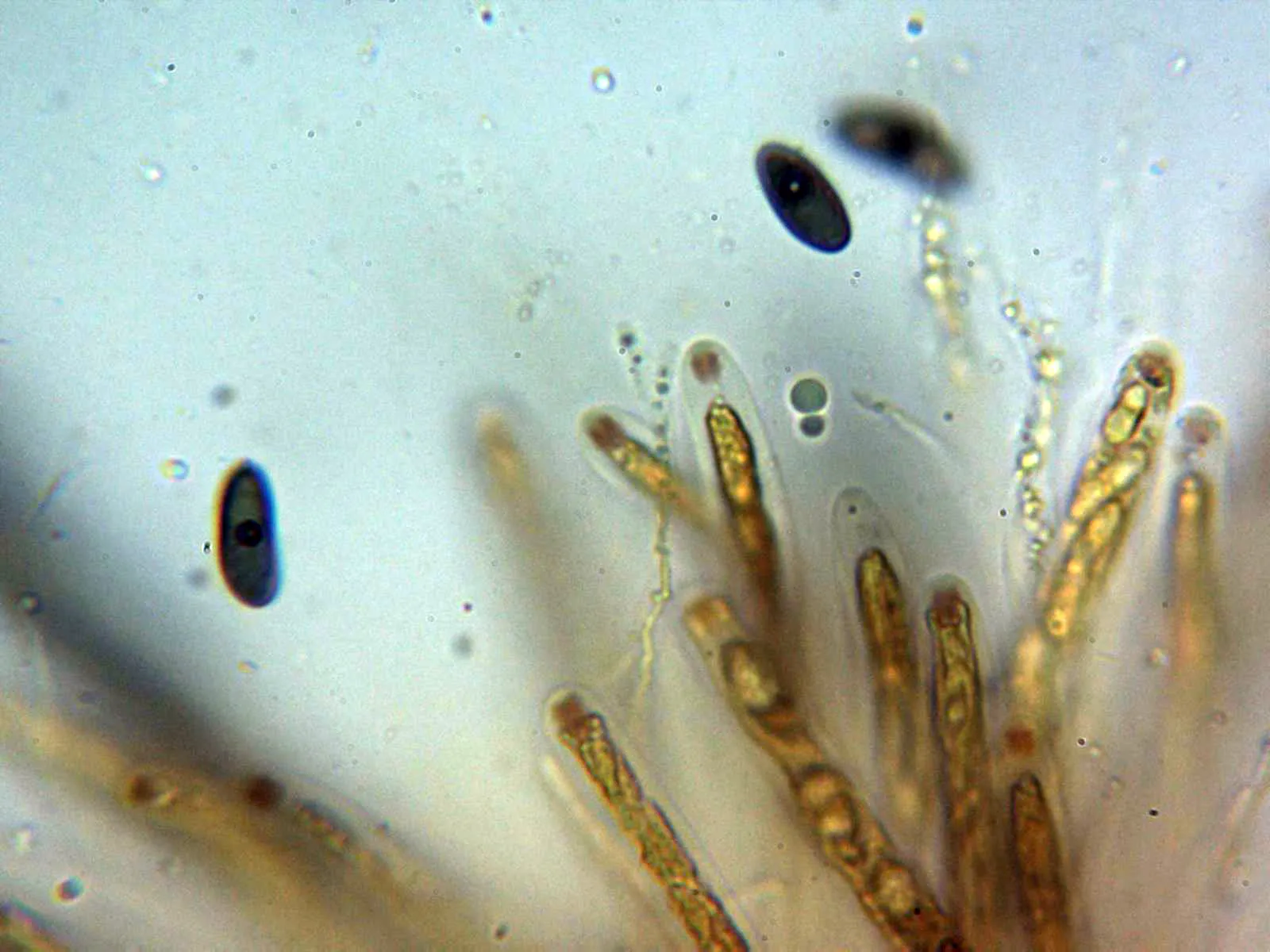 Microscopía de Nemania serpens - 10 - Ascas Melzer 1